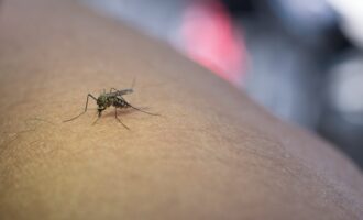 Přírodní prostředky proti štípancům od hmyzu - výborné na zmírnění zánětu a svědění